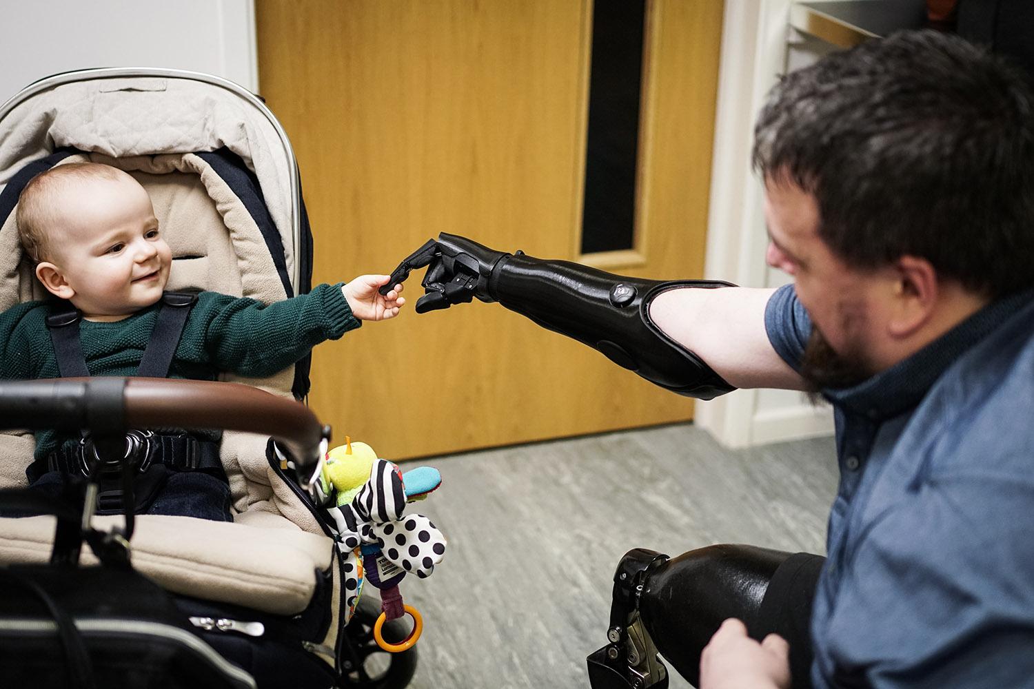 Danny gets his bionic hand